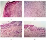 Querubin/Antibacter/D/P