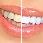 Cepillo Dental Whitening Carrefour 1 Un